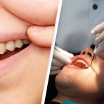 dentist reveals yellow teeth mistake