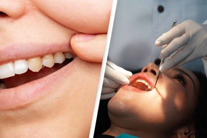 dentist reveals yellow teeth mistake